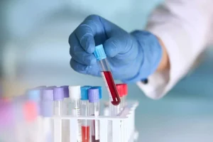 BLOOD-ALCOHOL-CONTENT