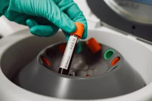 HOW-IS-BAC-CALCULATED? BLOOD ALCOHOL CONCENTRATION 